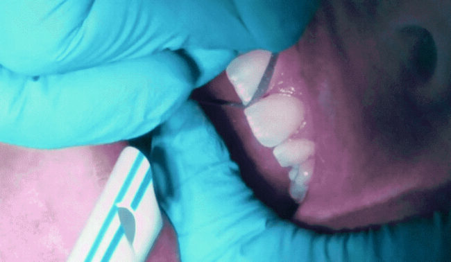 Blog -Dr Nina Shaffie