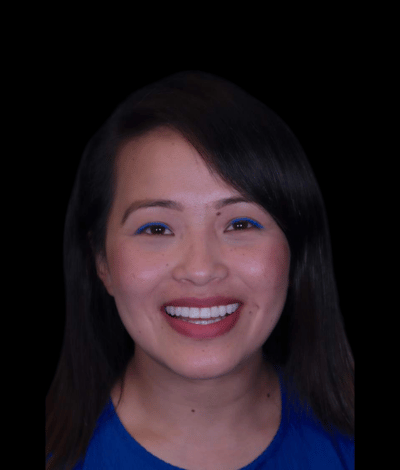face - Dr Nina Shaffie