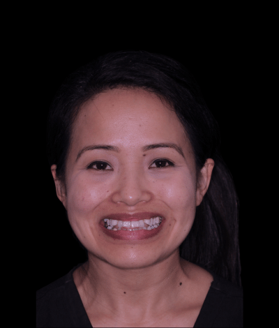 face - Dr Nina Shaffie