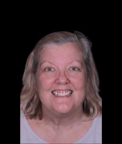 face - Dr Nina Shaffie