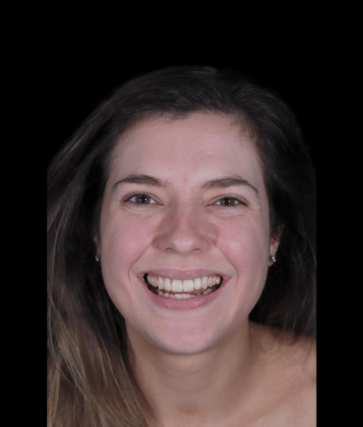face - Dr Nina Shaffie