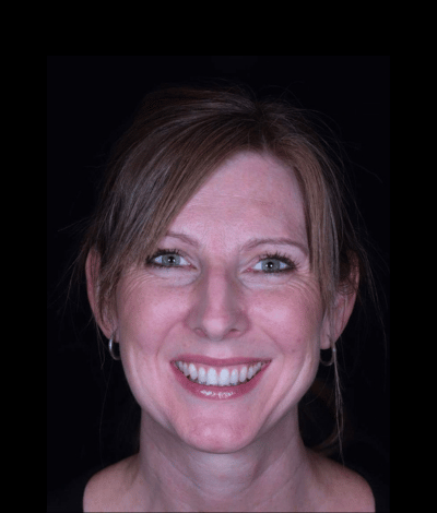 face - Dr Nina Shaffie