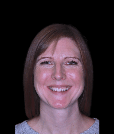face - Dr Nina Shaffie