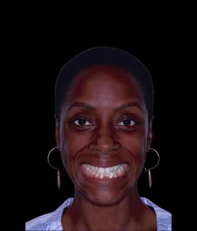face - Dr Nina Shaffie