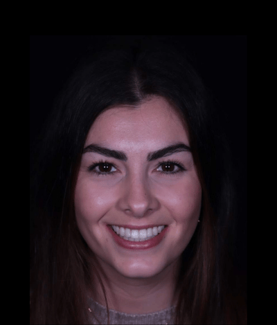 face - Dr Nina Shaffie