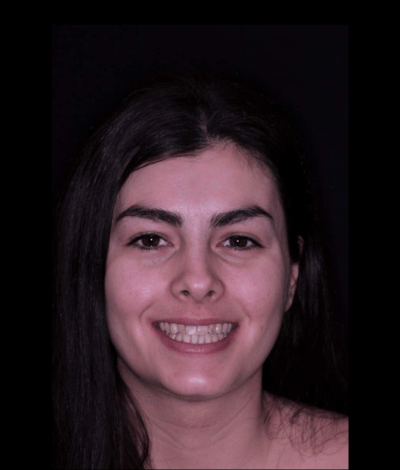 face - Dr Nina Shaffie