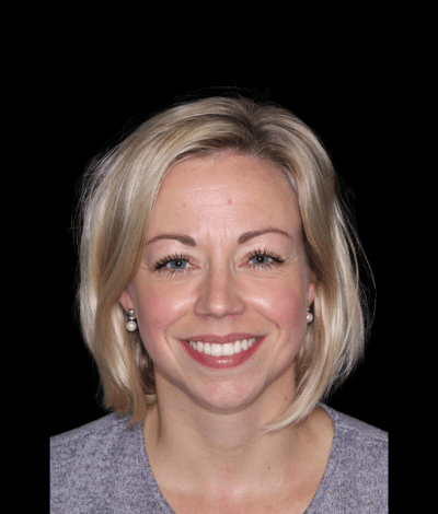 face - Dr Nina Shaffie