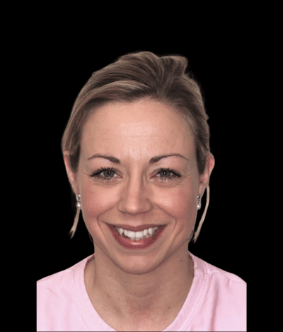 face - Dr Nina Shaffie