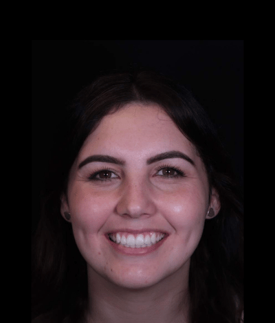 face - Dr Nina Shaffie