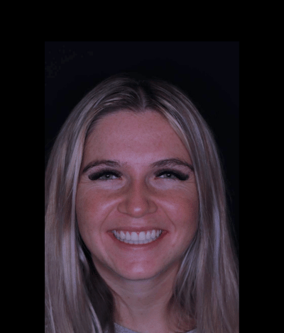 face - Dr Nina Shaffie