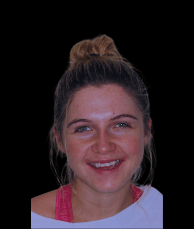 face - Dr Nina Shaffie