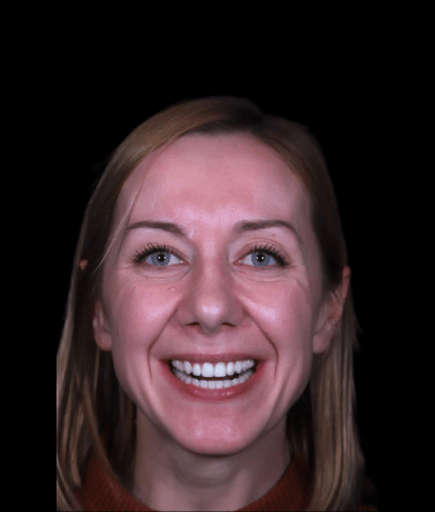 face - Dr Nina Shaffie