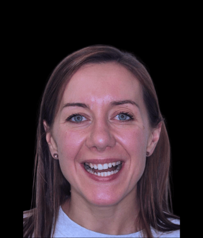 face - Dr Nina Shaffie