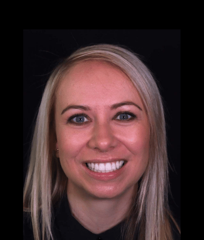face - Dr Nina Shaffie