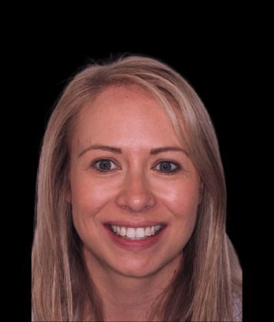 face - Dr Nina Shaffie