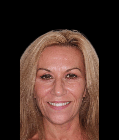 face - Dr Nina Shaffie