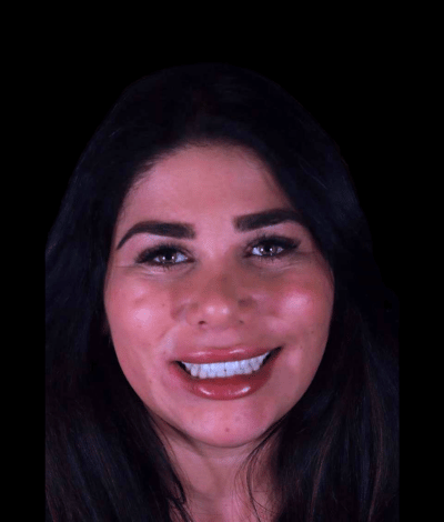 face - Dr Nina Shaffie