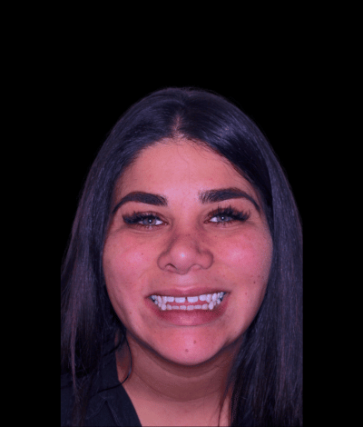 face - Dr Nina Shaffie