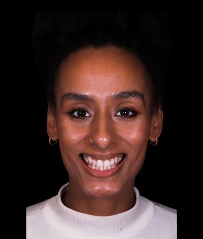 face - Dr Nina Shaffie