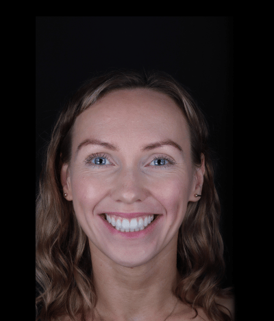 face - Dr Nina Shaffie