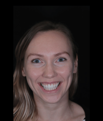 face - Dr Nina Shaffie