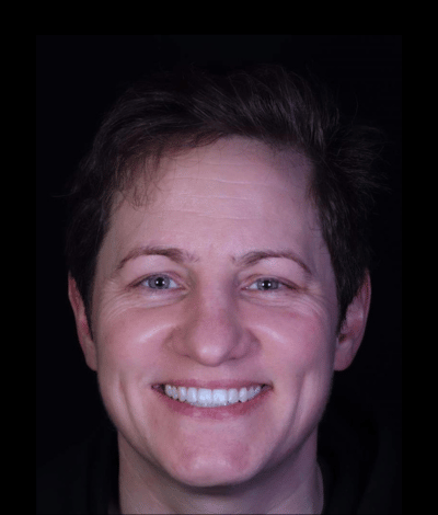 face - Dr Nina Shaffie