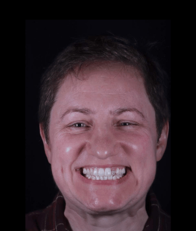 face - Dr Nina Shaffie