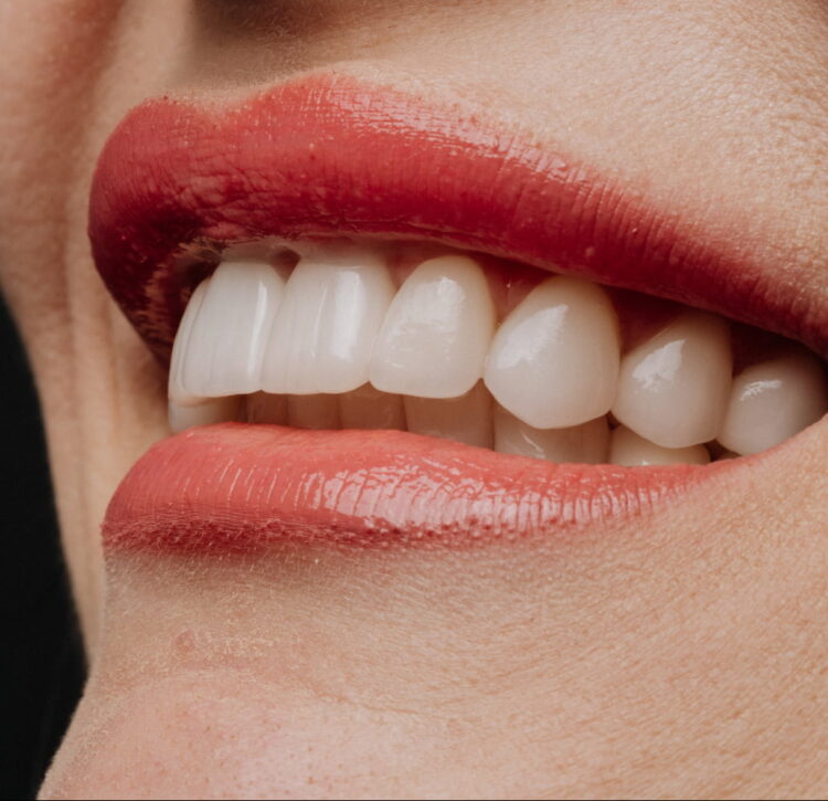 Advanced Orthodontics