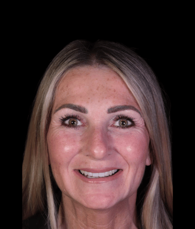 face - Dr Nina Shaffie