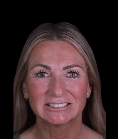 face - Dr Nina Shaffie