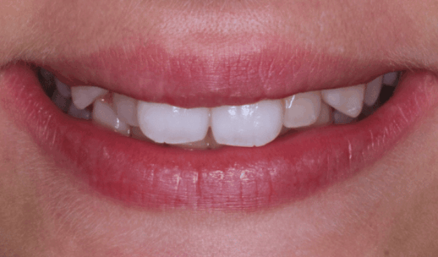 face - Dr Nina Shaffie