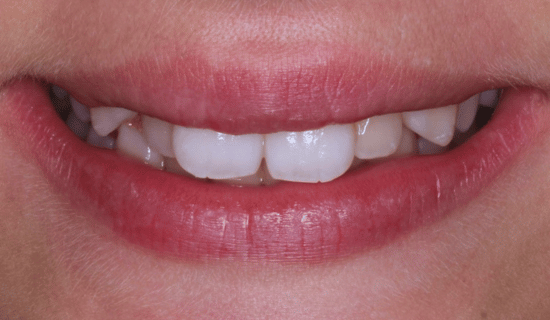 face - Dr Nina Shaffie