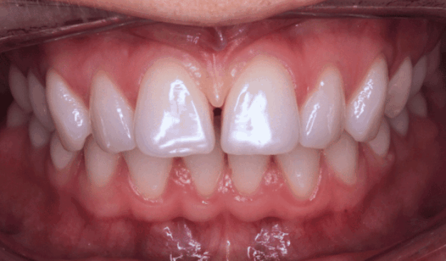 face - Dr Nina Shaffie