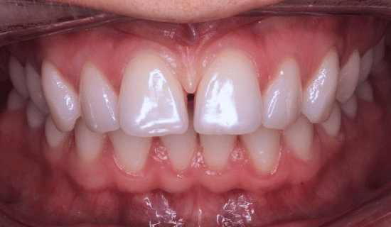 face - Dr Nina Shaffie