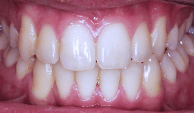 face - Dr Nina Shaffie