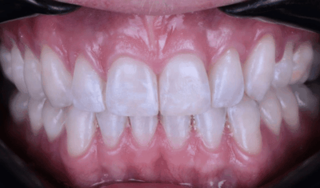 face - Dr Nina Shaffie