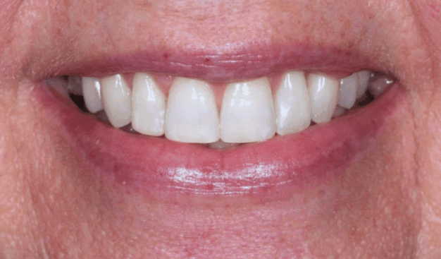 face - Dr Nina Shaffie