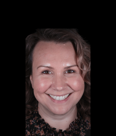 face - Dr Nina Shaffie
