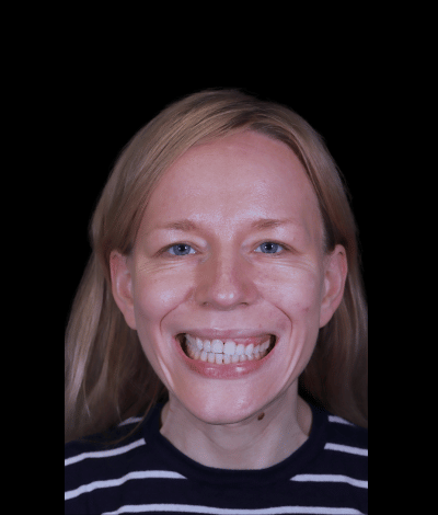 face - Dr Nina Shaffie