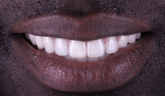 face - Dr Nina Shaffie