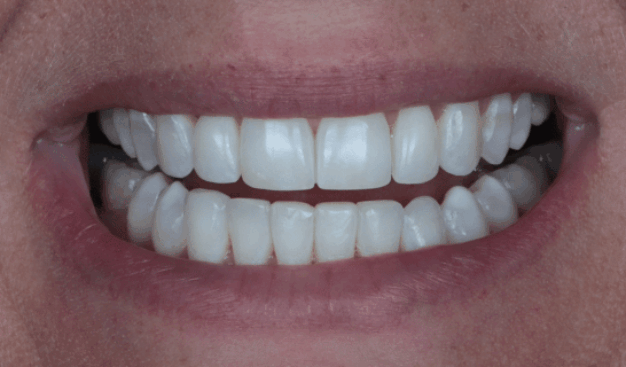 face - Dr Nina Shaffie