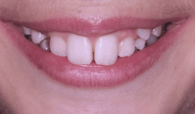 face - Dr Nina Shaffie