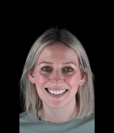 face - Dr Nina Shaffie