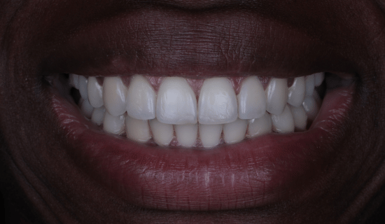 face - Dr Nina Shaffie