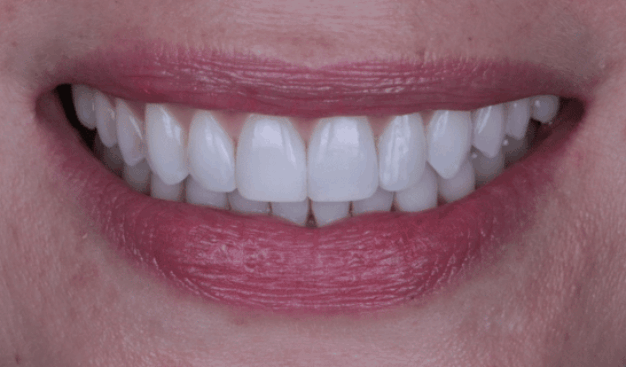 face - Dr Nina Shaffie