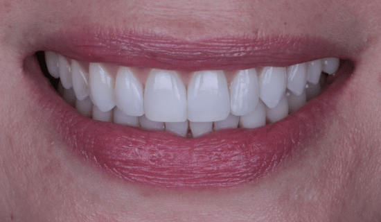 face - Dr Nina Shaffie