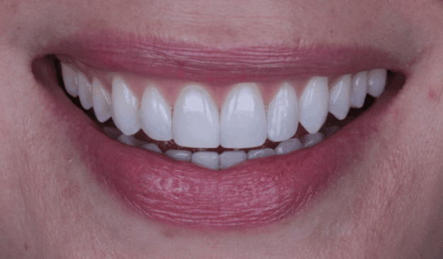 face - Dr Nina Shaffie
