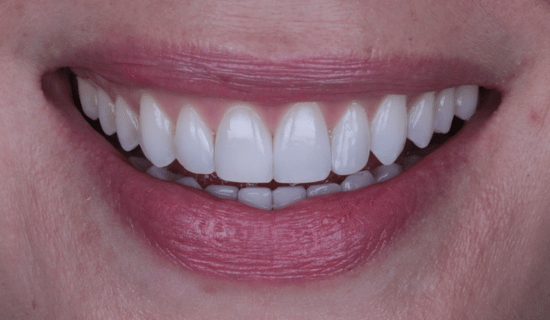 face - Dr Nina Shaffie