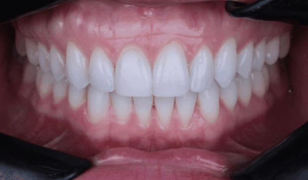 face - Dr Nina Shaffie