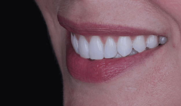 face - Dr Nina Shaffie